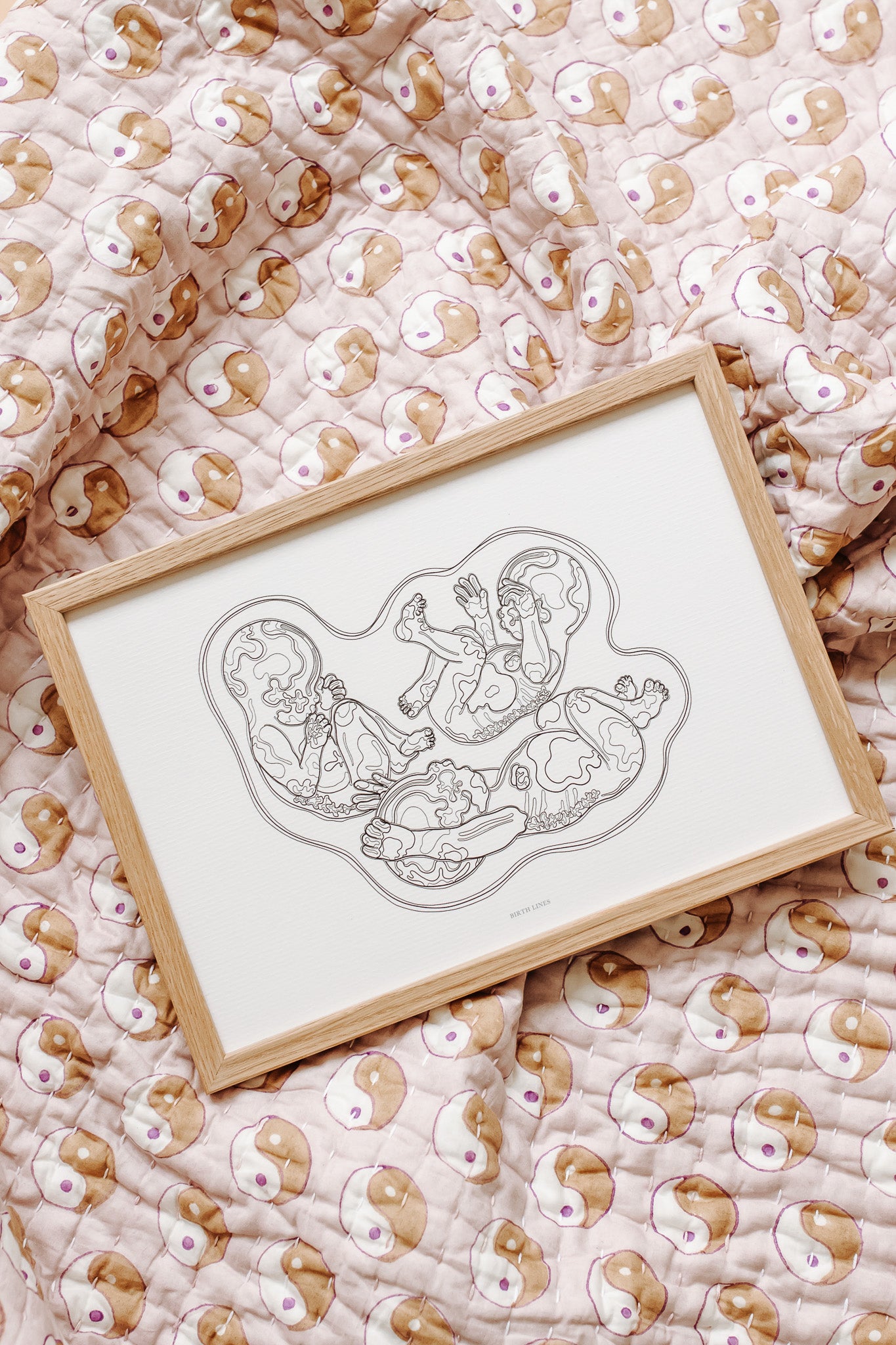 Birth Line echo-illustratie, drieling