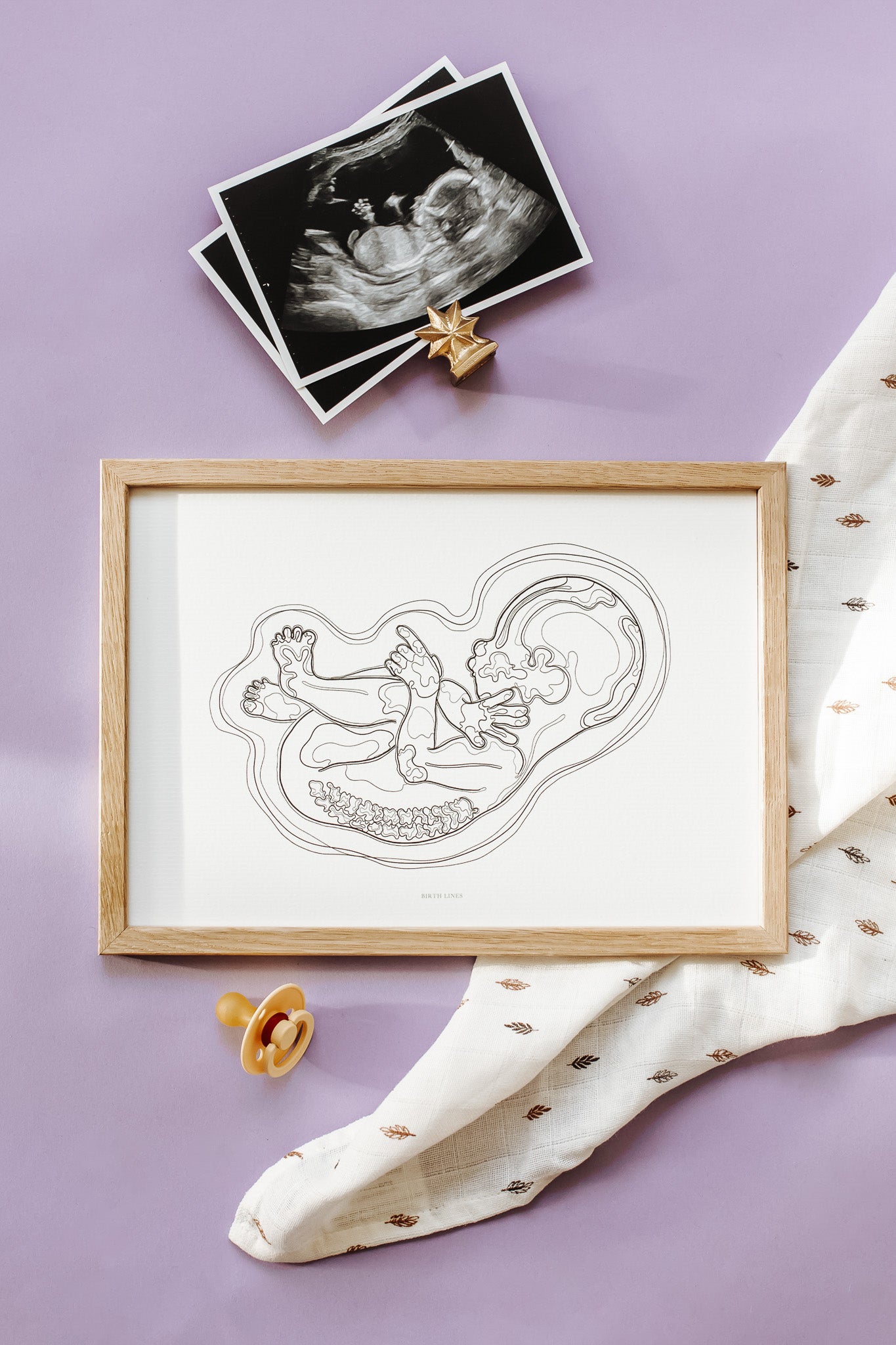 Birth Line echo-illustratie, eenling