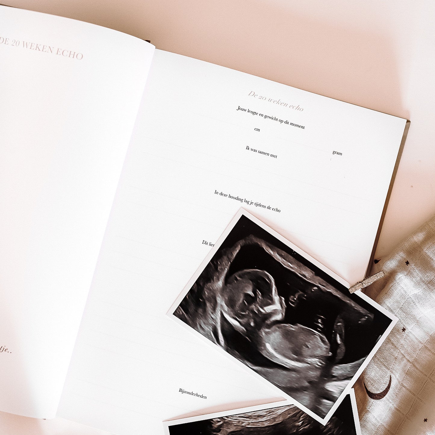 20 weken echo pagina zwangerschaps en baby eerste jaar invulboek met echo’s