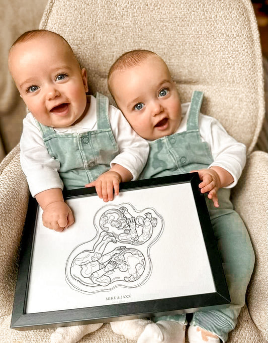 Birth Line echo-illustratie, tweeling