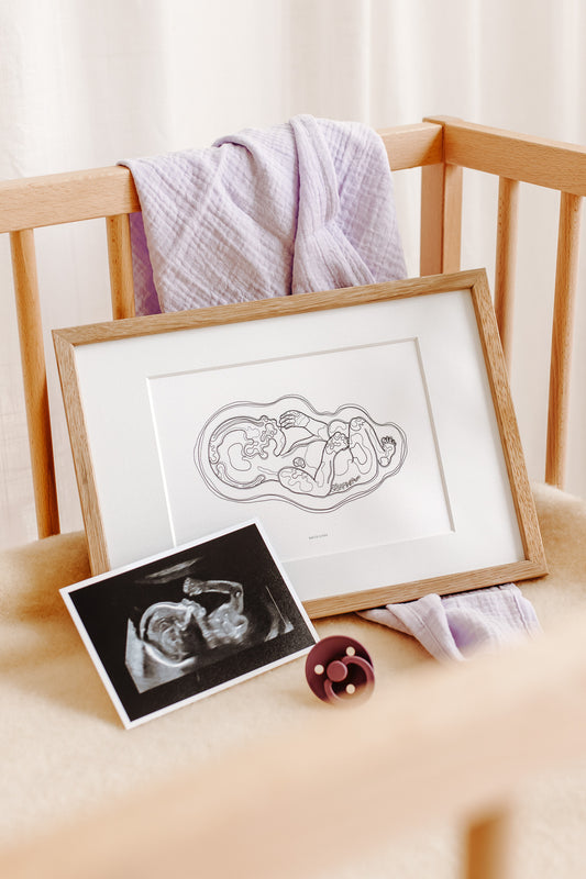 Birth Line echo-illustratie, eenling