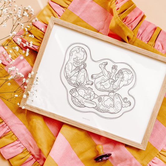 Birth Line echo-illustratie, drieling