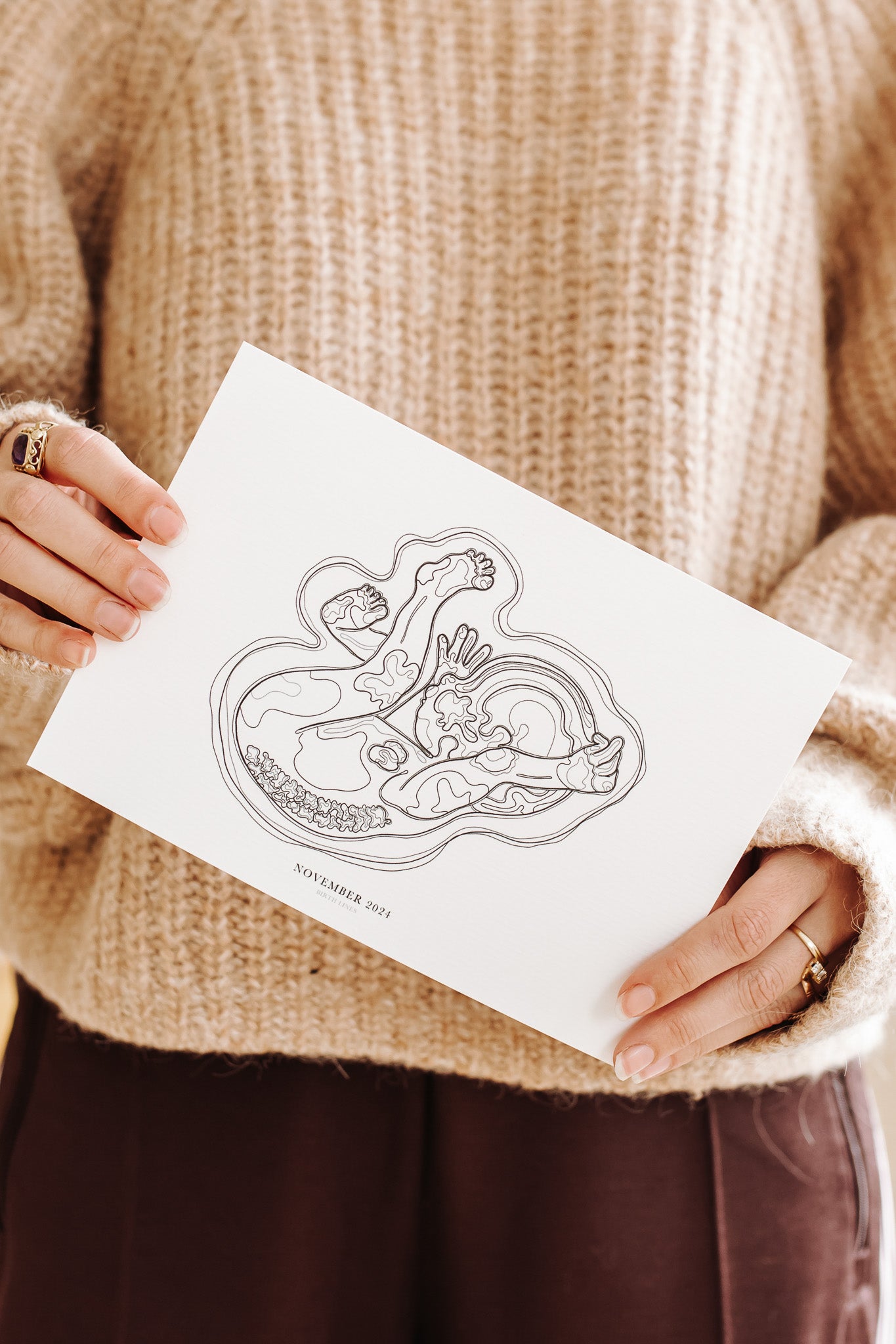 Birth Line echo-illustratie, eenling