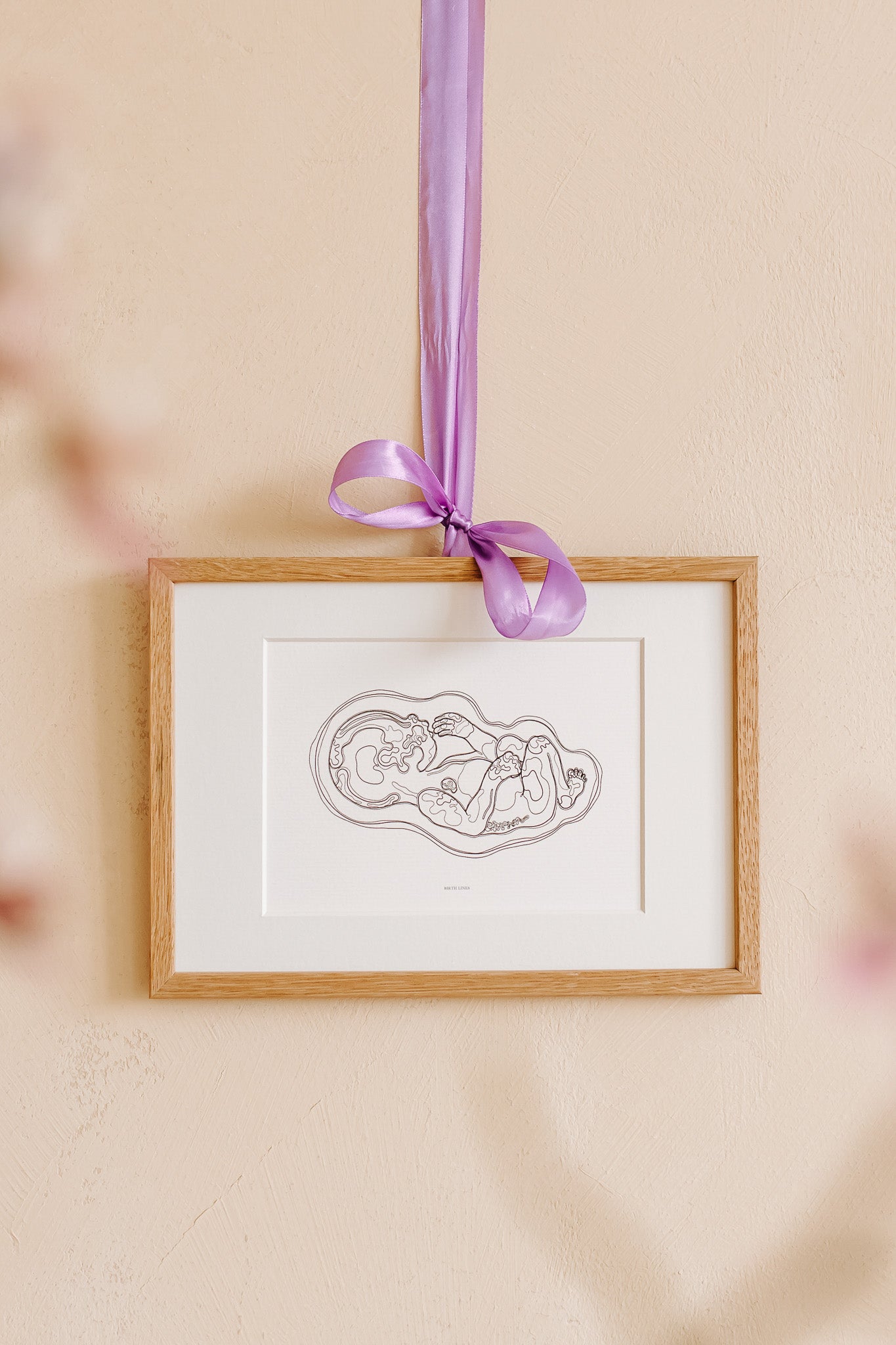 Birth Line echo-illustratie, eenling