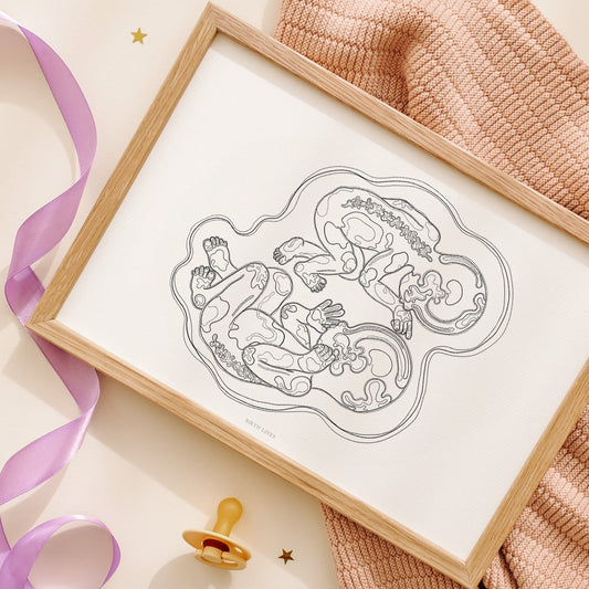 Birth Line echo-illustratie, tweeling