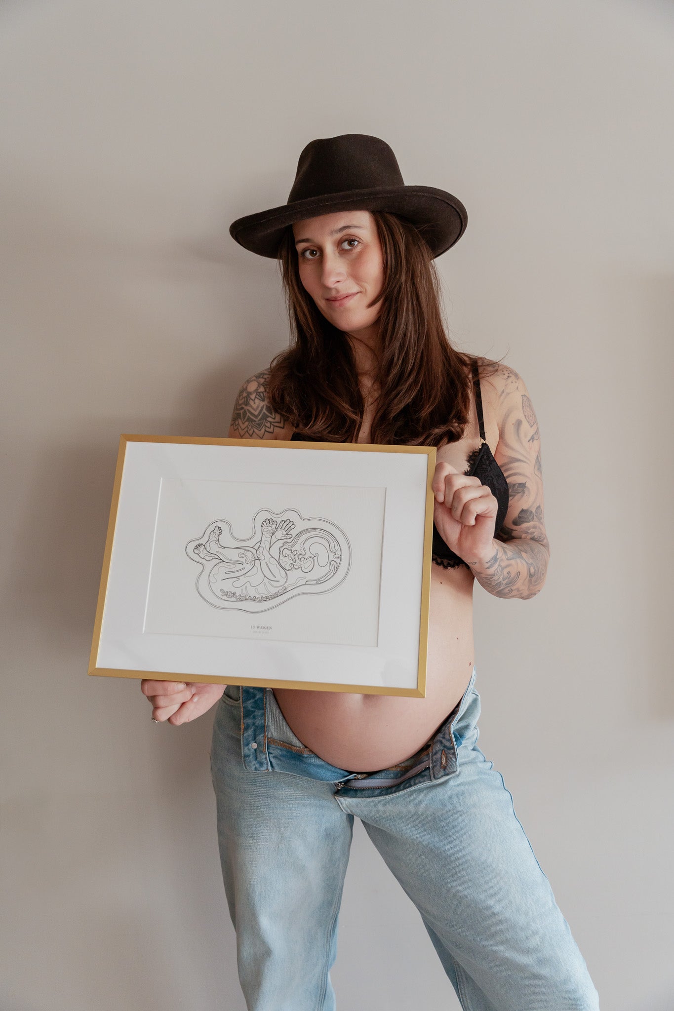 Birth Line echo-illustratie, eenling