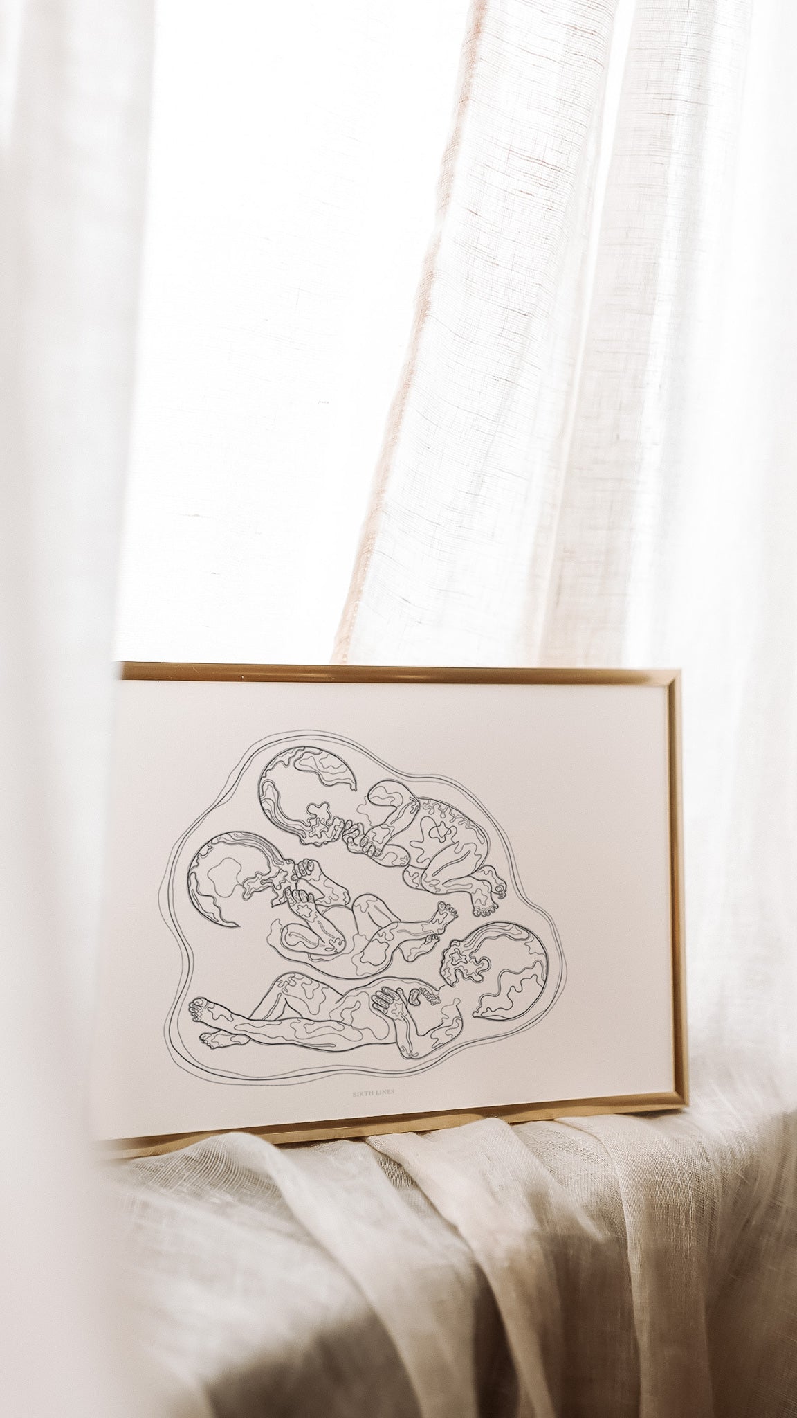 Birth Line echo-illustratie, drieling