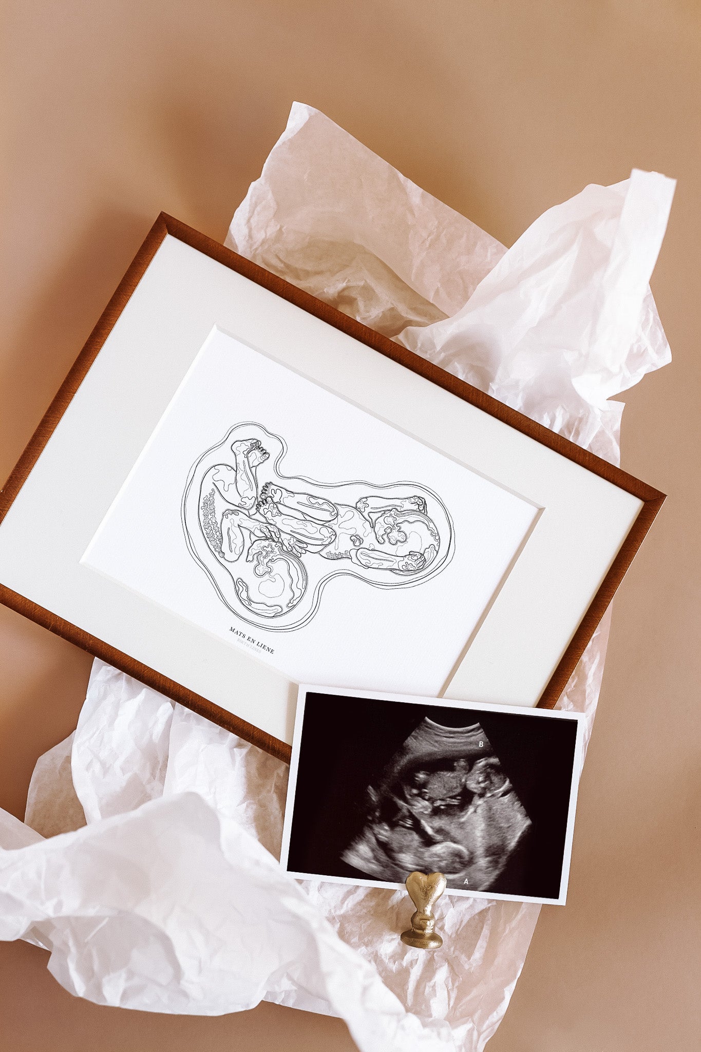 Birth Line echo-illustratie, tweeling