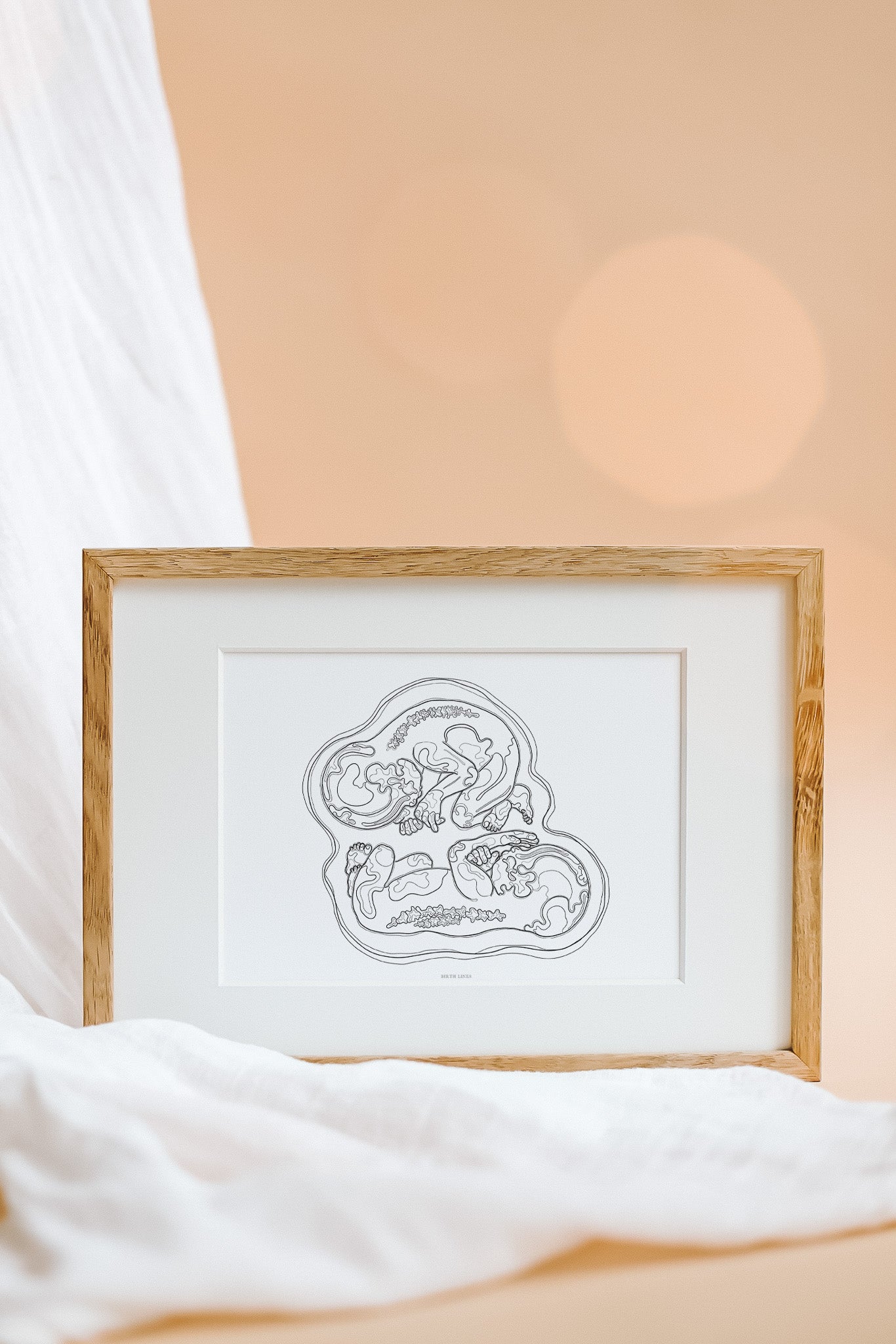 Birth Line echo-illustratie, tweeling